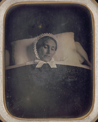 Anonyme - Femme sur son lit de mort, vue sous trois angles différents (ici, de f...
