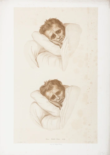Jean Bein - Portrait de Louis-Philippe
