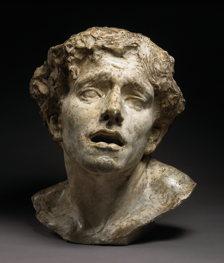 Jean Escoula - La Douleur